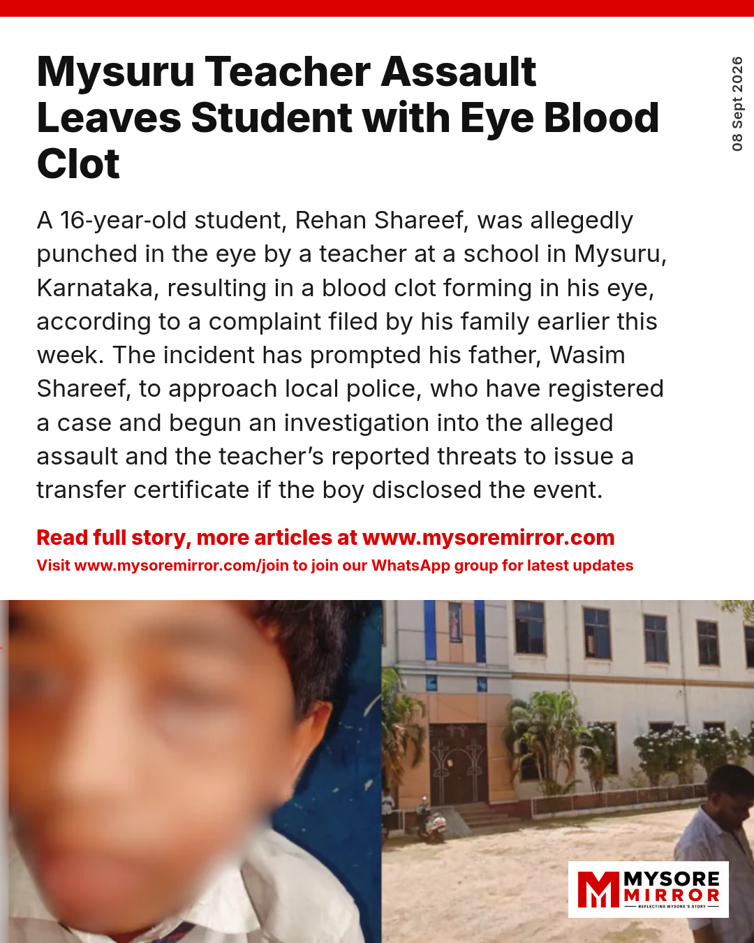 Mysuru Teacher Assault Leaves Student with Eye Blood Clot